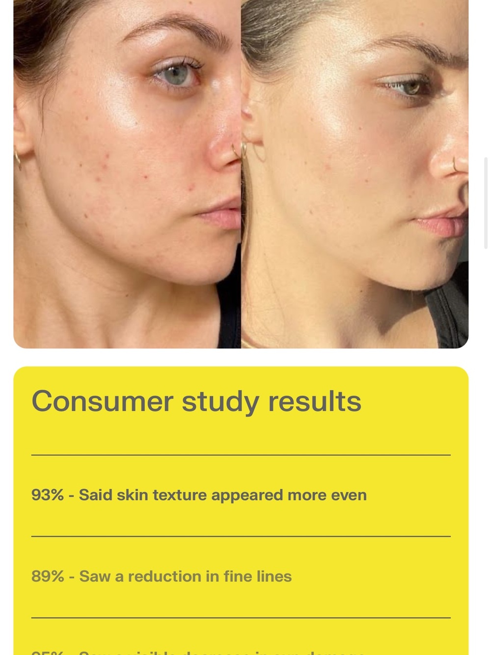 Sleepcell Retinol Serum - Picture 6 of 6
